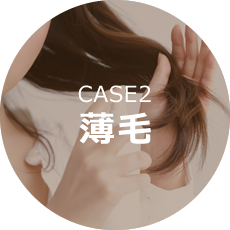 CASE2薄毛