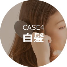 CASE4白髪